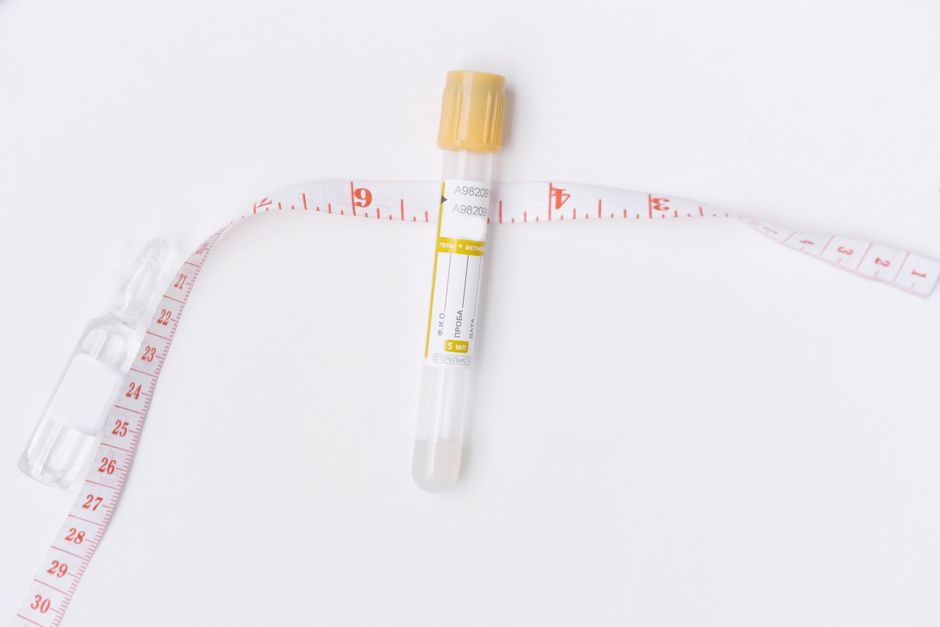 diagnostic sample tube, standing in for the in vitro testing context of this iSENS stock analysis