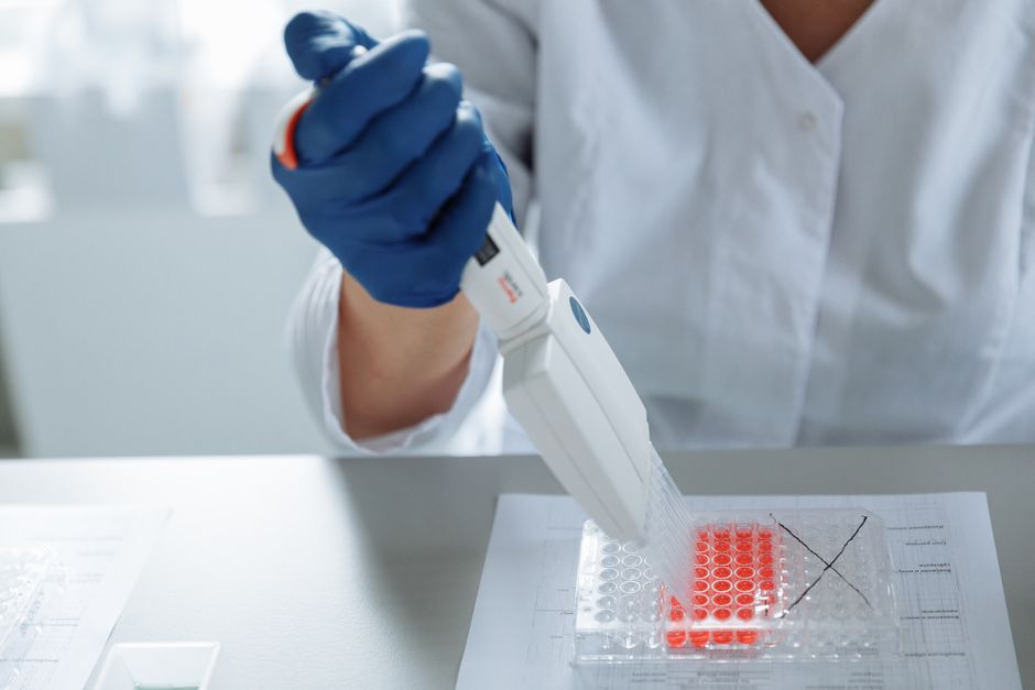 Samsung Epis Holdings outlook story laboratory pipetting photo